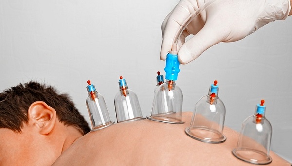  روایات حجامت